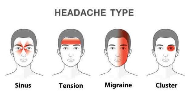 This is How Headaches Reveal What is Wrong With Your Health.