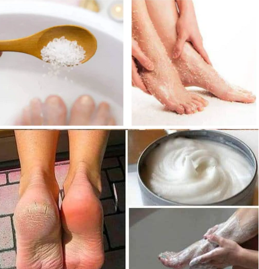 Baking Soda Pedicure