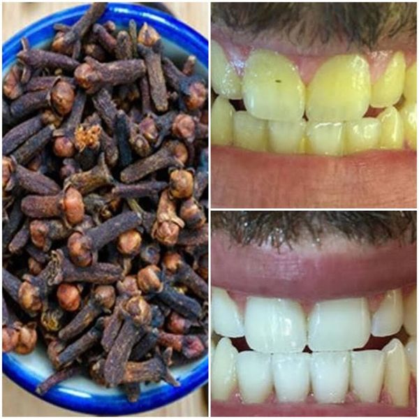 Teeth-Whitening Paste